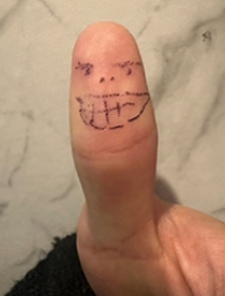 おやゆび涼太